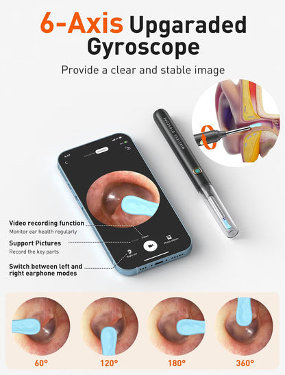 Ear Wax Removal Camera